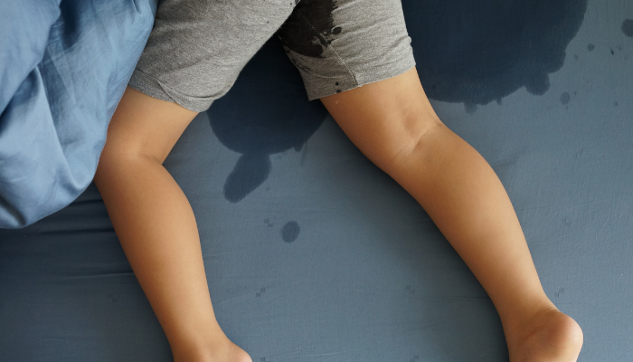 bedplassen, bedplassen kind, tot wanneer bedplassen kind, mijn kind plast nog in bed, plaswekker, kind 5 jaar , kind 7 jaar